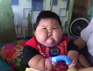 Bayi 16 Bulan Beratnya 27 Kg, Dinkes: Itu Setara Anak Berusia 10-11 Tahun