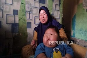 Bayi Chubby Gemoy Belum Tentu Sehat, Apa yang Bisa Dilakukan Jika Telanjur Obesitas?