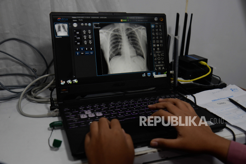 Dokter Spesialis Anak: TB Bukan Penyakit Keturunan