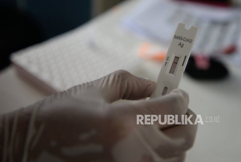 Masyarakat Diimbau Lakukan Tes Antigen Mandiri Apabila Bergejala Covid-19 Arcturus