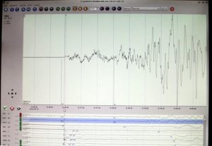 BMKG Catat 365 Gempa Bumi di Sumba NTT Sepanjang April