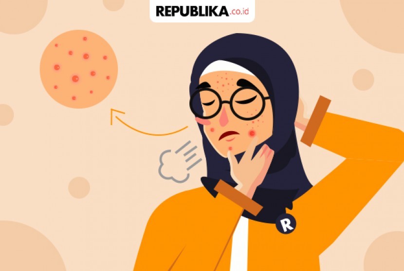 Dampak Skin Barrier Rusak: Jerawat HIngga Risiko Penuaan Dini