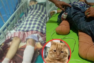 Prabowo Jenguk dan Semangati Nabila si Penyelamat Kucing yang Kakinya Harus Diamputasi